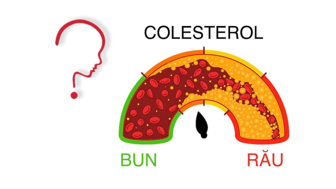 Valori normale ale colesterolului si trigliceridelor